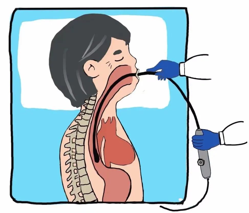 小探頭看大病 | 經(jīng)食道超聲立大功！